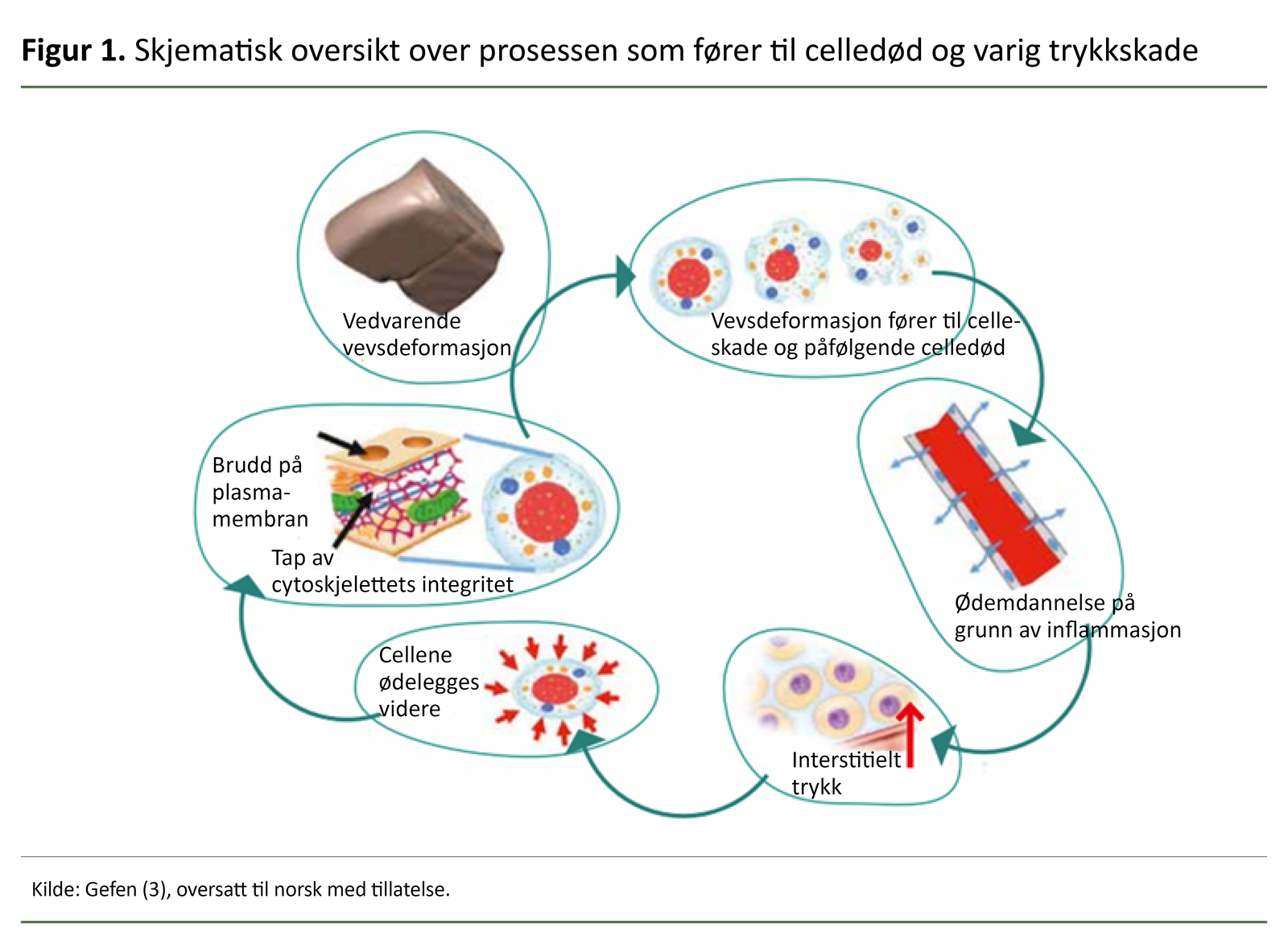 Skjematisk oversikt over prosessen som fører til celledød og varig trykkskade