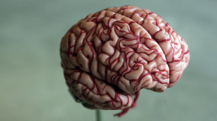 Bilde viser modell av hjerne