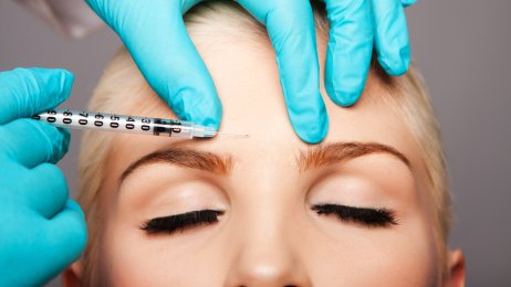 Bildet viser en kvinne som for injisert botox