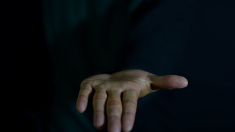 Bildet viser en håndflate som er strukket ut 