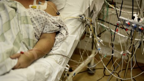 Bildet viser en intensivpasient som ligger i en sykehusseng påkoplet mye medisinsk utstyr