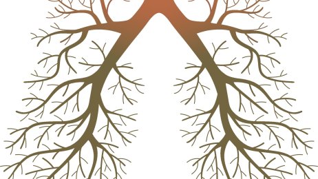 Lunger, lungesykdom Illustrasjon av lunger i form av et tre med greiner