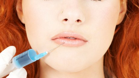 Filler i leppene Bildet viser en ung jente som blir injisert med en sprøyte i leppene.