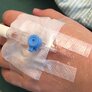 Bildet viser et perifert venekateter på en arm