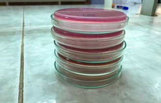 Mikrobiologiske prøver i laboratorium.