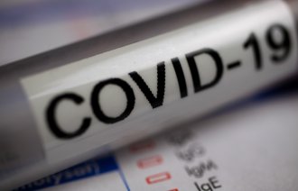 Bildet viser et reagensrør som det er skrevet covid-19 på