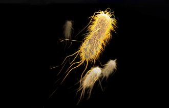 Bildet viser ESBL (extended-spectrum ­beta-lactamase).