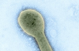 Bildet viser partikkel av marburgvirus.