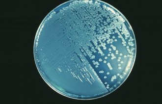 Bildet viser en petriskål med Pseudomonas aeruginosa.