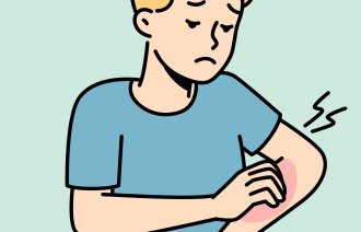 Illustrasjonen viser en gutt som klør seg på armen.