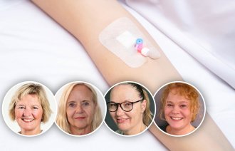 Bildet viser en arm med perifert venekateter.