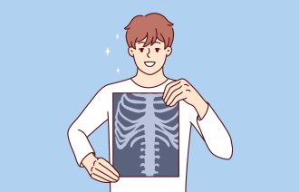 Illustrasjonen viser en gutt som holder opp et røntgenbilde av thorax.