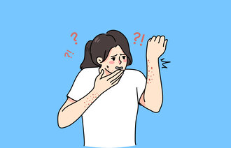 Illustrasjonen viser en kvinne med utslett på armene.