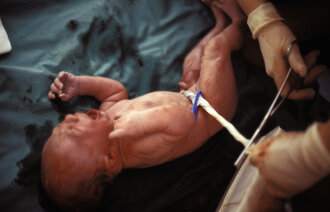 Bilde av nyfødt baby