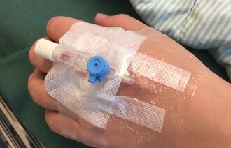 Bildet viser et perifert venekateter på en arm