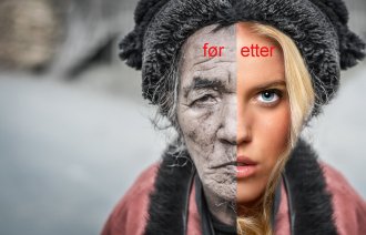 Bildet viser humoristisk overdrevet før og etter kosmetisk kirurgi