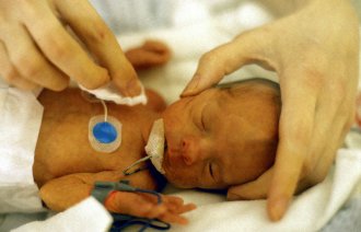 Prematurt barn som stelles i kuvøse