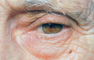 Illustrasjonsfoto: Mostphotos