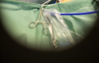 Viser operasjon gjennom dørvinduet inn til operasjonsstua