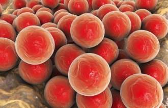 Illustrasjonen viser gule stafylokokker.