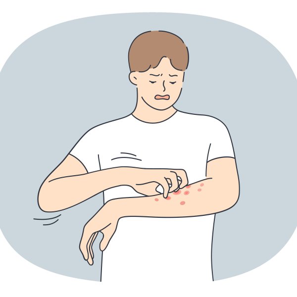 Illustrasjonen viser en mann som klør på et utslett på armen.