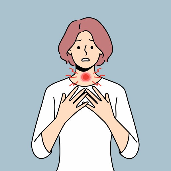 Illustrasjonen viser en kvinne med problemer med skjoldkjertel.