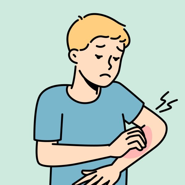 Illustrasjonen viser en gutt som klør seg på armen.