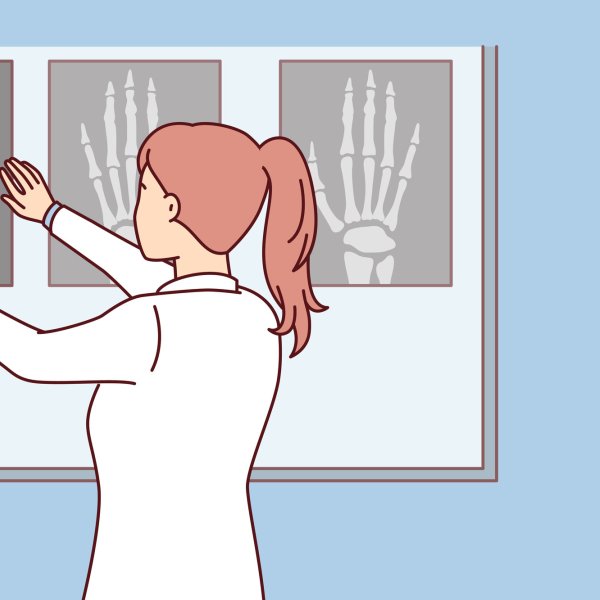 Illustrasjonen viser en helsearbeider som ser på røntgenbilder.