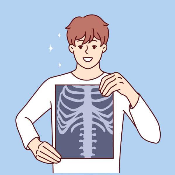 Illustrasjonen viser en gutt som holder opp et røntgenbilde av thorax.