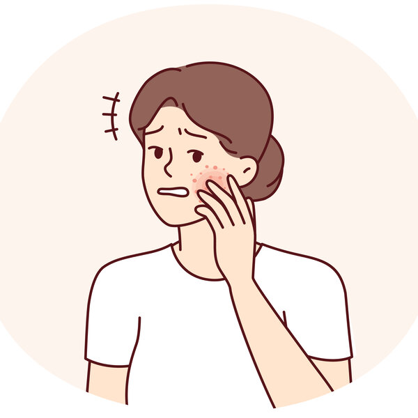 Illustrasjonen viser en kvinne med utslett på kinnet.