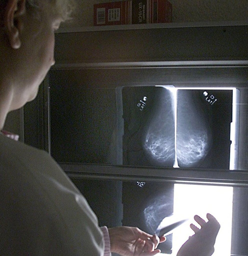 Røntgenbilde Røntgenbilde