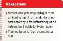 Trakeostomi.jpg (Ingress 220)