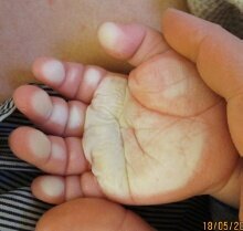 Caroline hånd 1.jpg