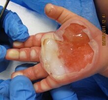 Caroline hånd 2.jpg