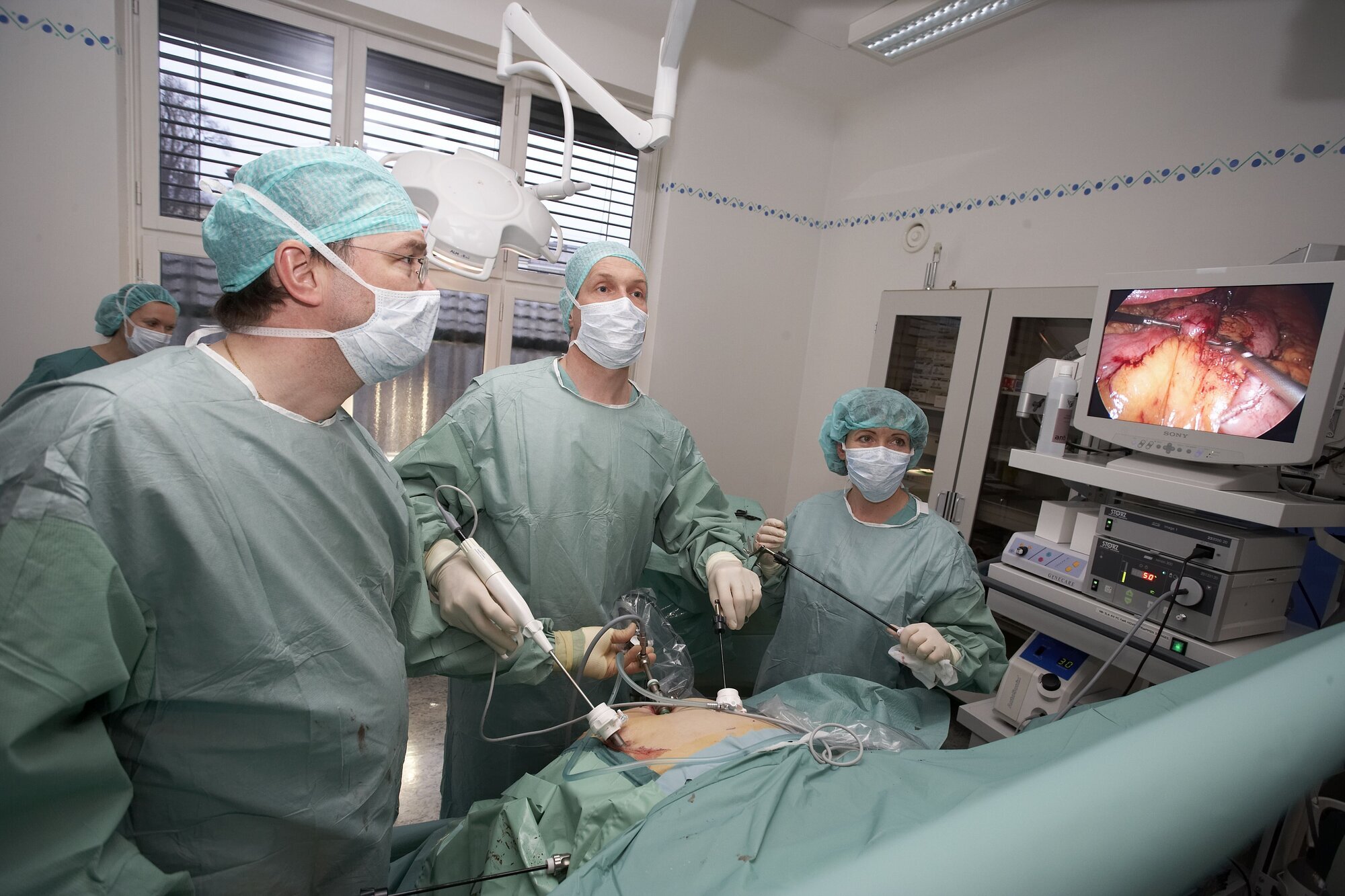 Kirurger utfører hysteroskopi, og følger med på en skjerm.
