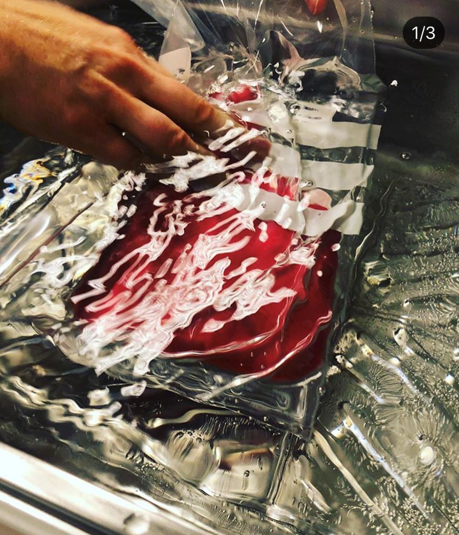 Avdeling for blodsykdommer, Oslo universitetssykehus, Rikshospitalet Bildet viser en pose med stamceller.