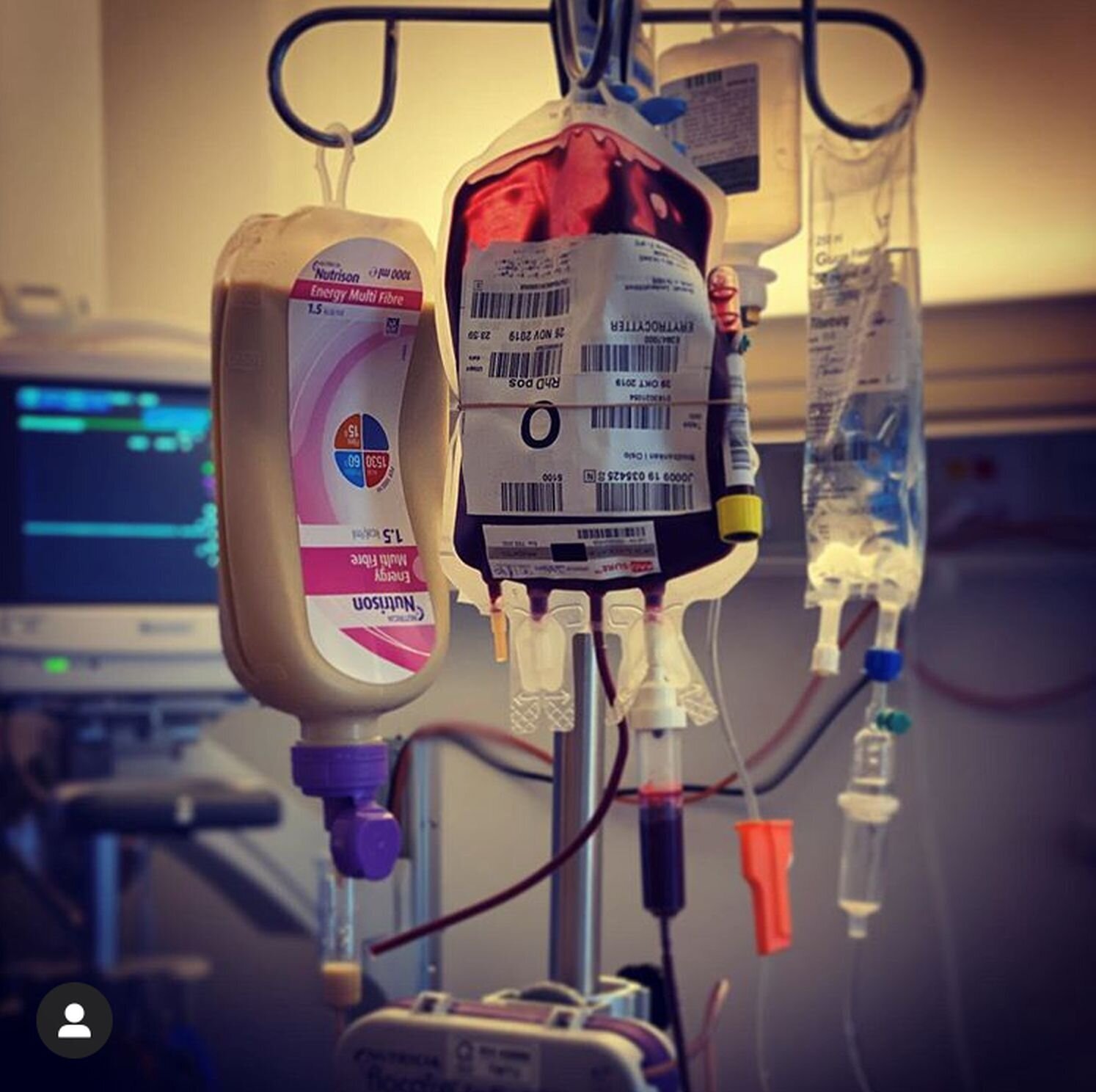 Avdeling for blodsykdommer, Oslo universitetssykehus, Rikshospitalet Bildet viser et stativ med blodpose, intravenøs ernæring og væske.