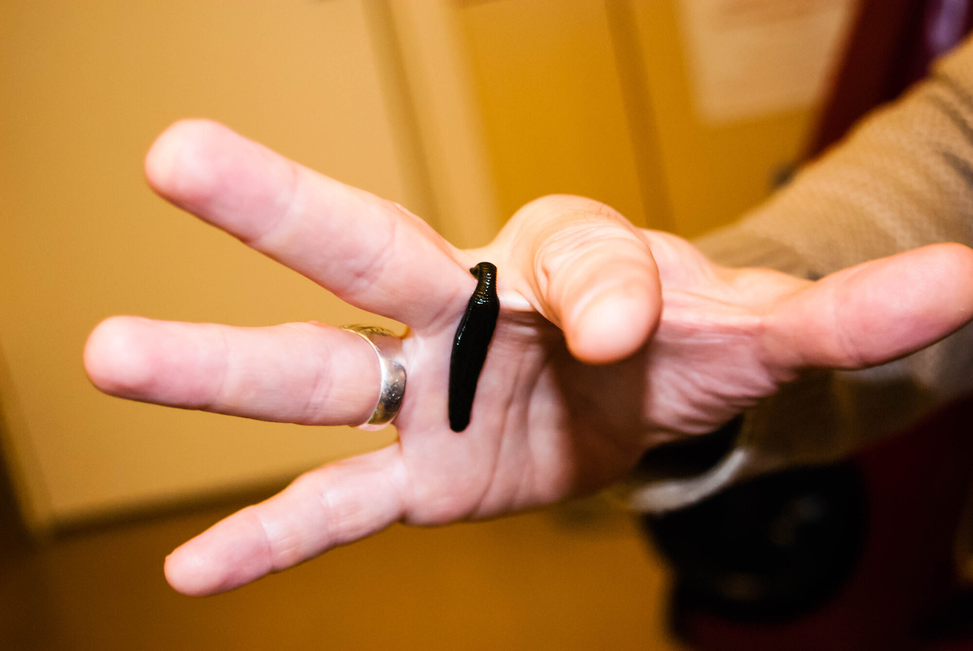 Blodigler kan redde påsydde fingre. Blodigle på hånd