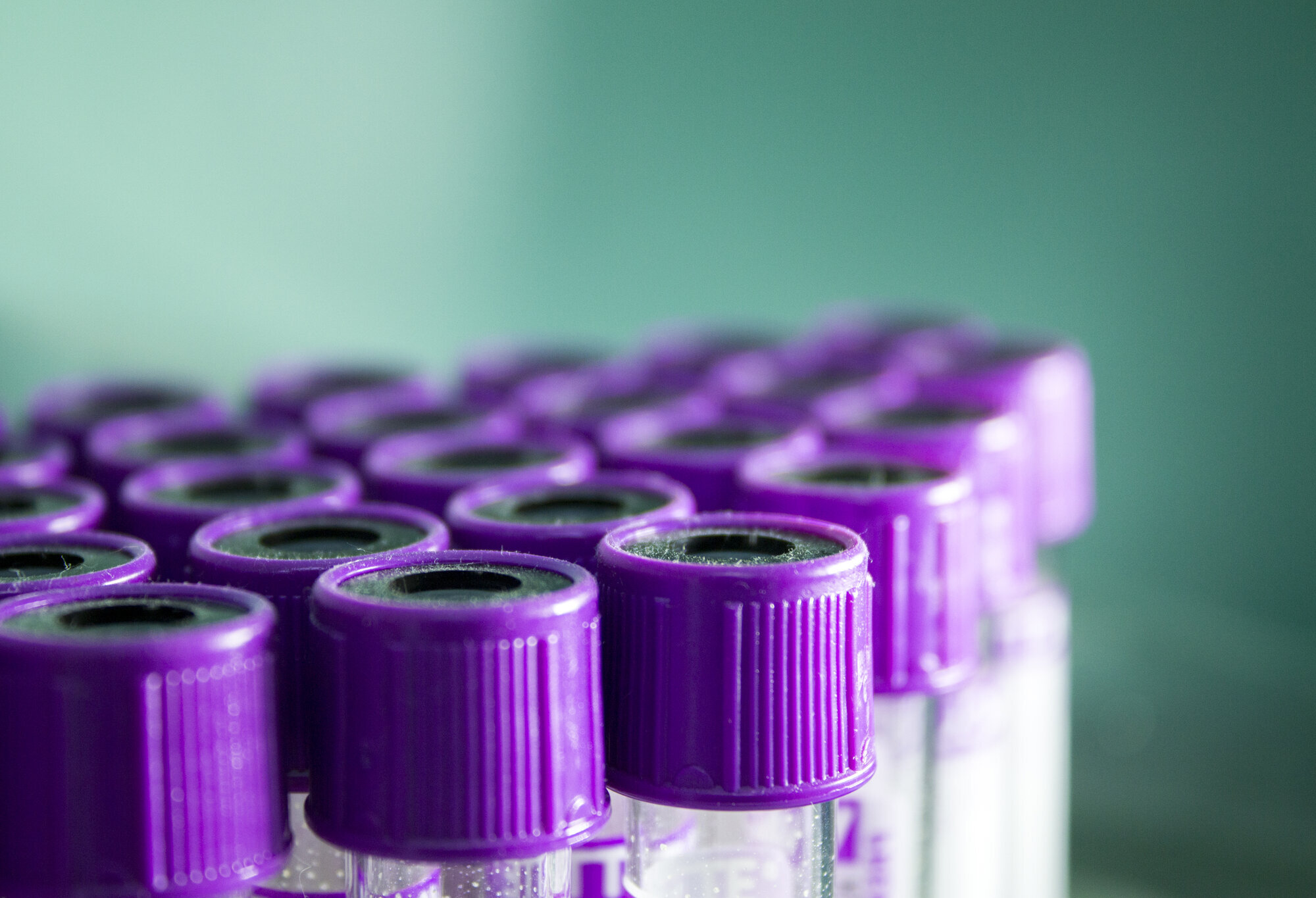 Blodprøver, prøveglass Bildet viser blodprøveglass.