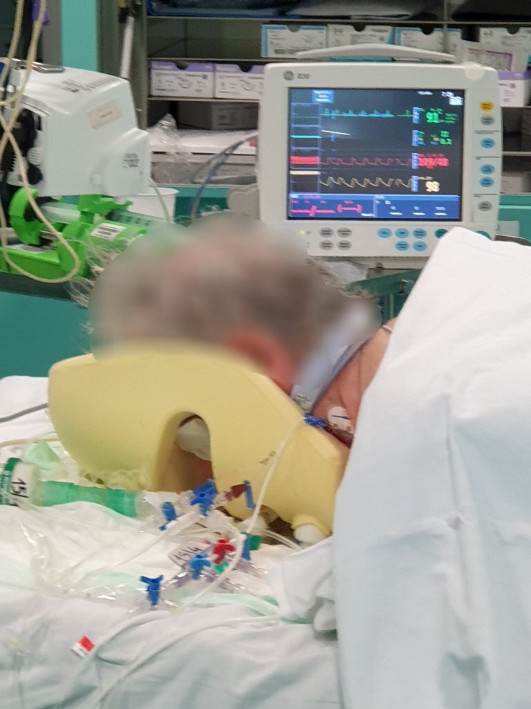 Medisinsk innsatsteam Bildet viser en anonymisert pasient som ligger på magen.