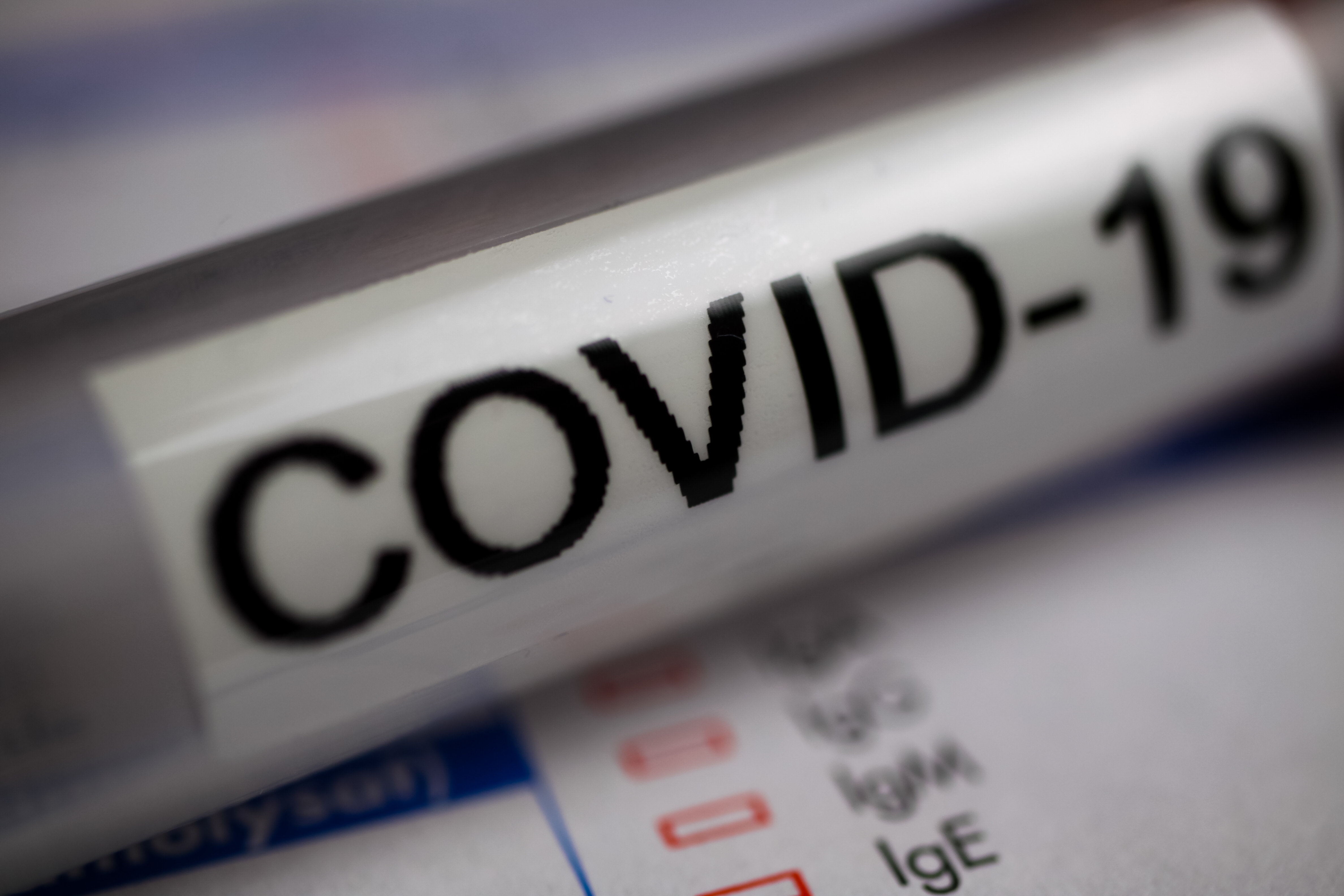 Covid-19 Bildet viser et reagensrør som det er skrevet covid-19 på