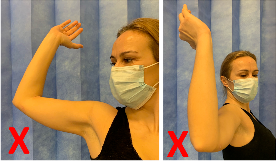 Bilde 2. Kombinasjon av abduksjon, utadrotasjon og retraksjon.