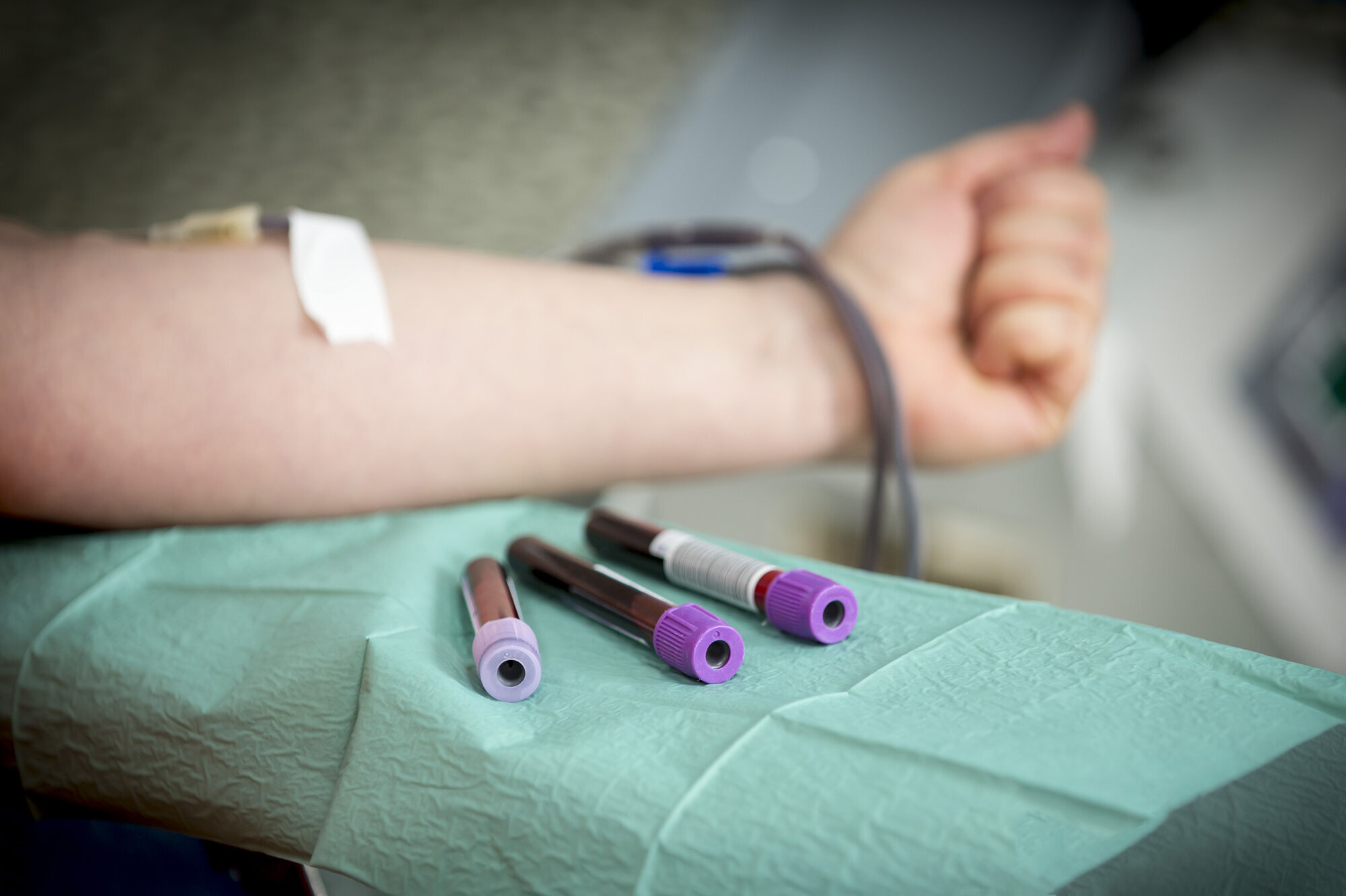 Bildet viser at det blir tatt blodprøver av et menneske. Ved siden av armen ligger tre prøveglass.