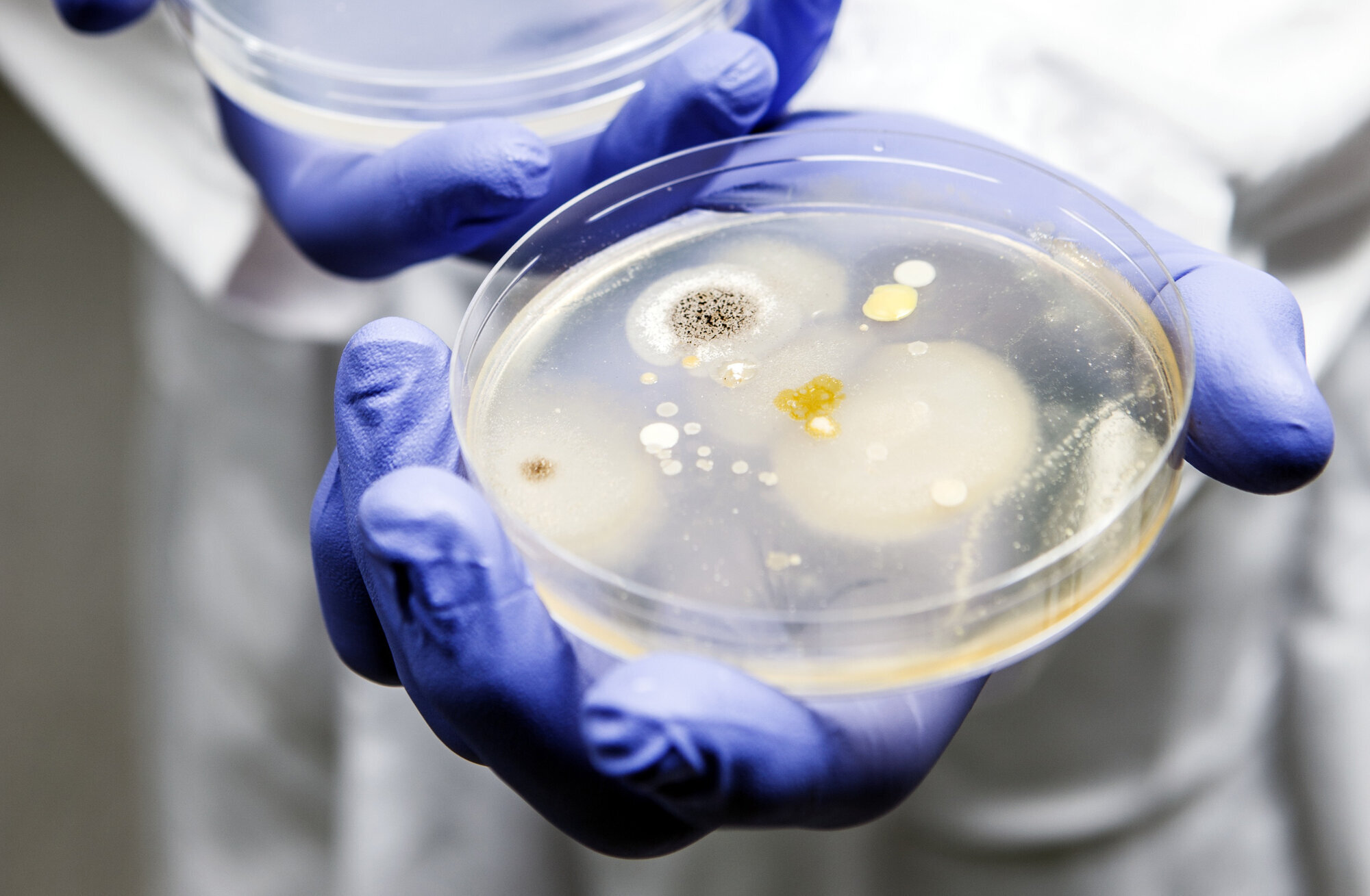 Petriskål med penicillin og bakterievekster. Bildet viser petriskål med penicillin og bakterievekster.