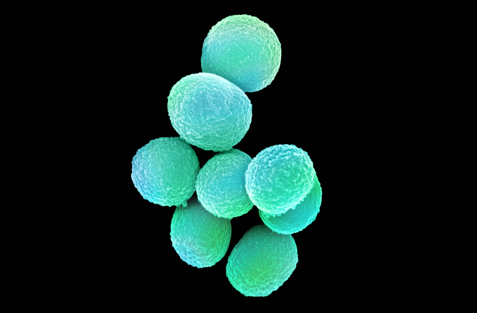 MRSA (meticillinresistente gule stafylokokker) Bildet viser MRSA (meticillinresistente gule stafylokokker).
