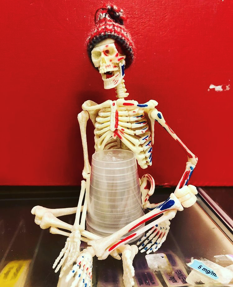 Ortopedisk overvåkning, Oslo universitetssykehus, Ullevål Bildet viser Beinar.