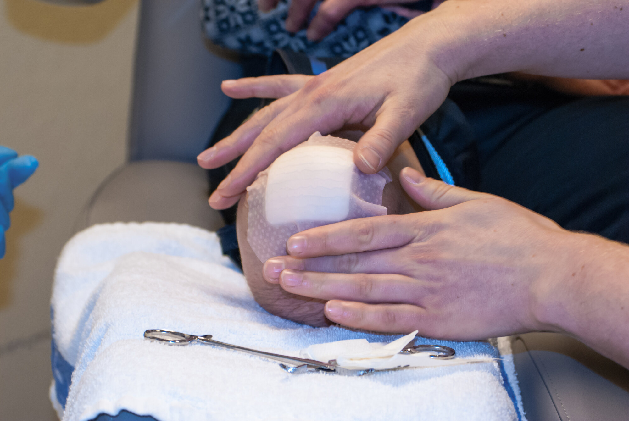 Stell og sjekk av beinstump etter amputasjon. Stell og sjekk av beinstump etter amputasjon.