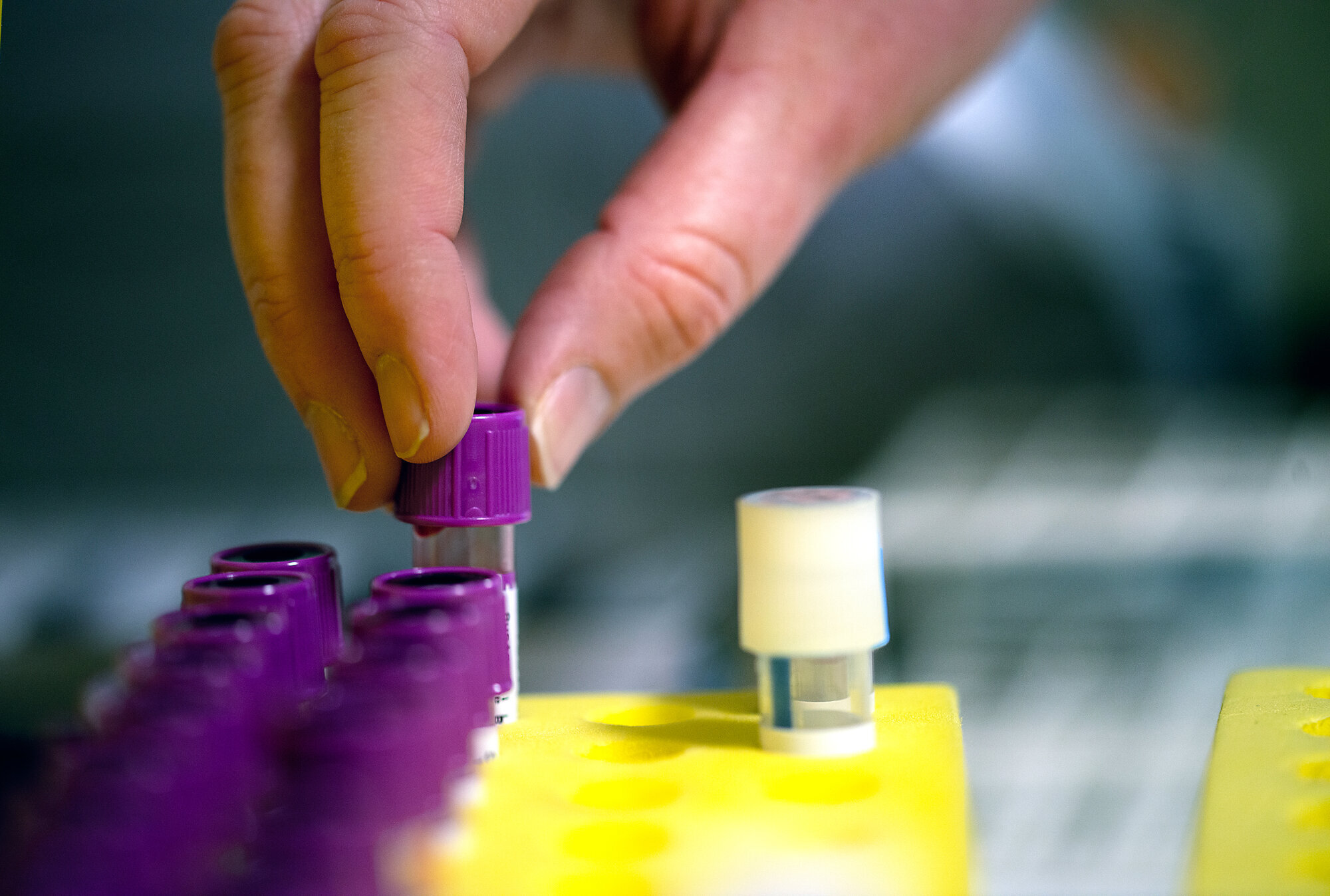 En person setter blodprøver i et stativ En person setter blodprøver i et stativ