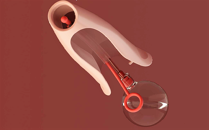 Prototype av spekulum med ballongkateter. Prototype av spekulum med ballongkateter.