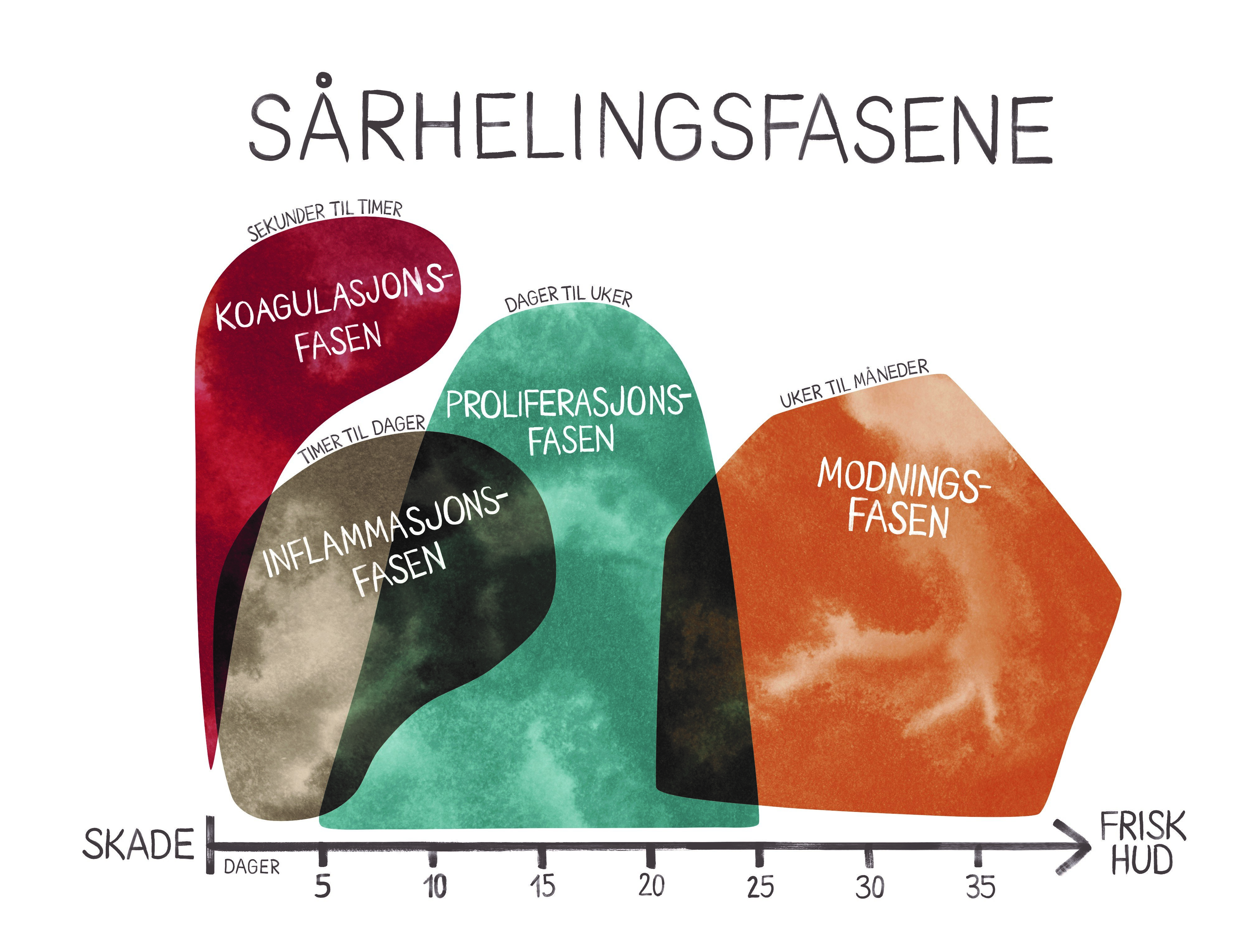 Sårhelingsfasene Illustrasjonen viser de fire sårhelingsfasene.